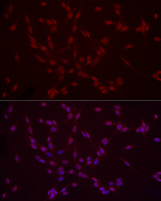 H3K9me2 Antibody in Immunocytochemistry (ICC/IF)