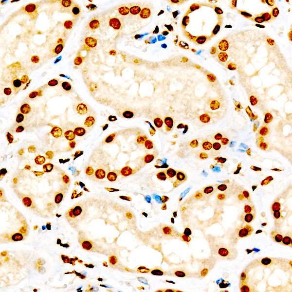 H3K9me2 Antibody in Immunohistochemistry (Paraffin) (IHC (P))