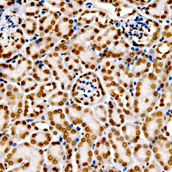 H3K9me2 Antibody in Immunohistochemistry (Paraffin) (IHC (P))