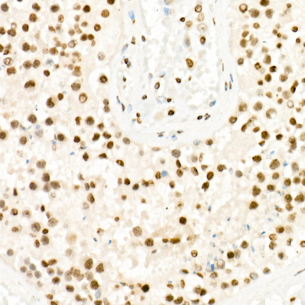 H3K27me3 Antibody in Immunohistochemistry (Paraffin) (IHC (P))