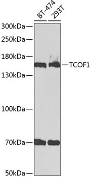 TCOF1 Antibody in Western Blot (WB)