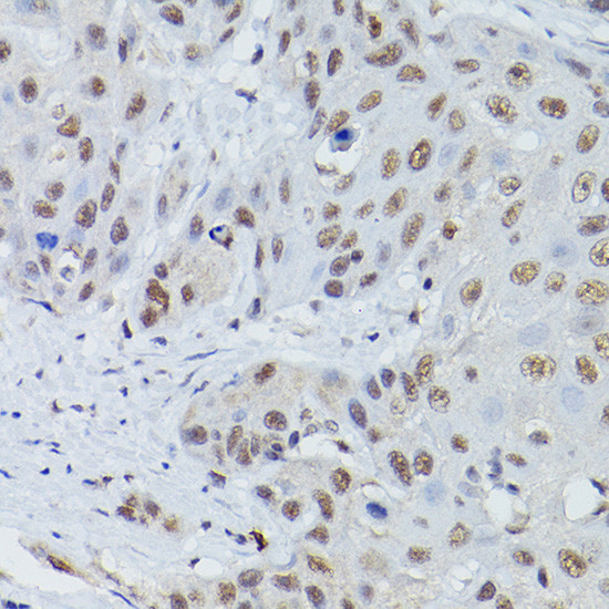 MRE11 Antibody in Immunohistochemistry (Paraffin) (IHC (P))