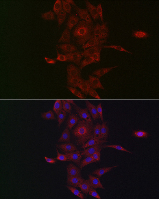 Neuropilin 2 Antibody in Immunocytochemistry (ICC/IF)