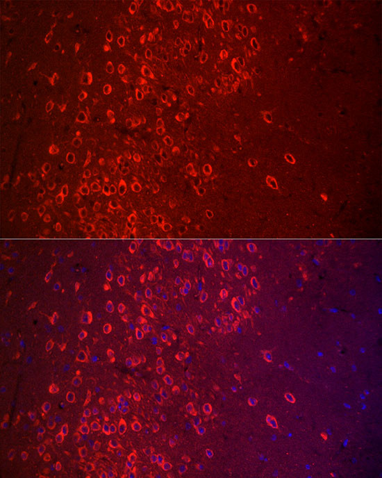 APLP1 Antibody in Immunohistochemistry (Paraffin) (IHC (P))