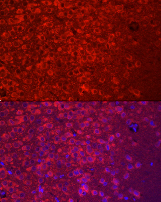 APLP1 Antibody in Immunohistochemistry (Paraffin) (IHC (P))