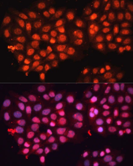 ABCB8 Antibody in Immunocytochemistry (ICC/IF)