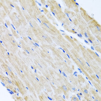 ABCB8 Antibody in Immunohistochemistry (Paraffin) (IHC (P))