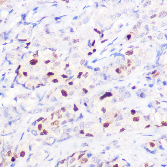 p21 Antibody in Immunohistochemistry (Paraffin) (IHC (P))