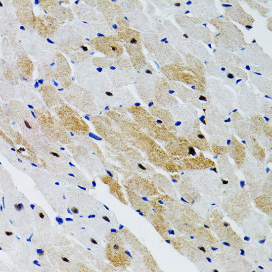 SHP2 Antibody in Immunohistochemistry (Paraffin) (IHC (P))