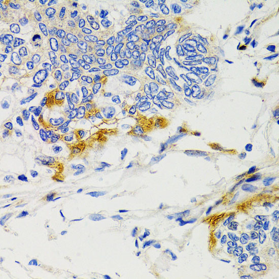 SHP2 Antibody in Immunohistochemistry (Paraffin) (IHC (P))