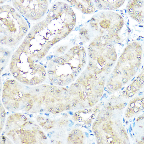 VCP Antibody in Immunohistochemistry (Paraffin) (IHC (P))