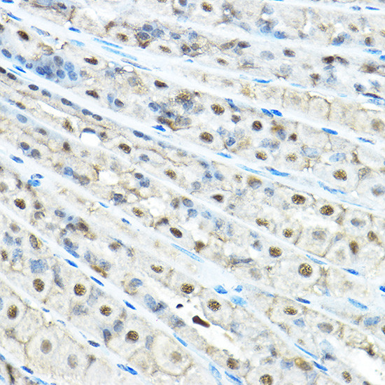 VCP Antibody in Immunohistochemistry (Paraffin) (IHC (P))