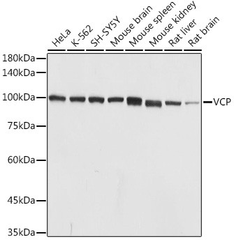 VCP Antibody in Western Blot (WB)