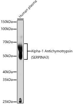 SERPINA3 Antibody in Western Blot (WB)