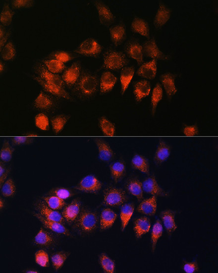 BDKRB2 Antibody in Immunocytochemistry (ICC/IF)