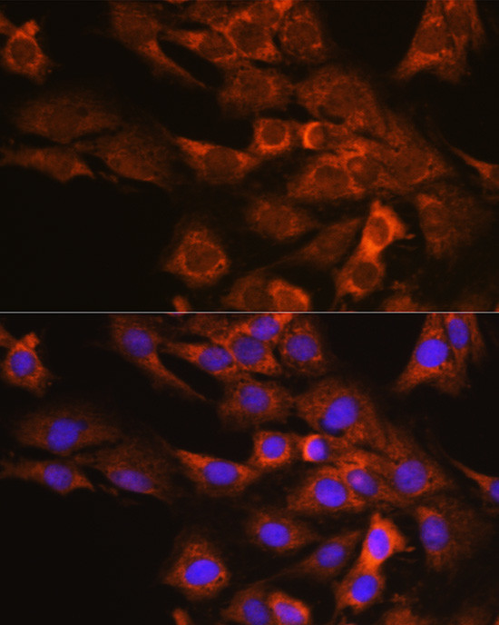 DAP5 Antibody in Immunocytochemistry (ICC/IF)