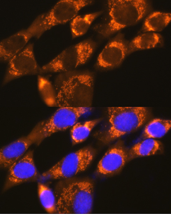 DAP5 Antibody in Immunocytochemistry (ICC/IF)