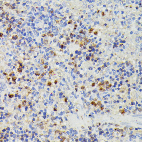 DUT Antibody in Immunohistochemistry (Paraffin) (IHC (P))