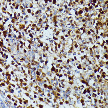 DUT Antibody in Immunohistochemistry (Paraffin) (IHC (P))