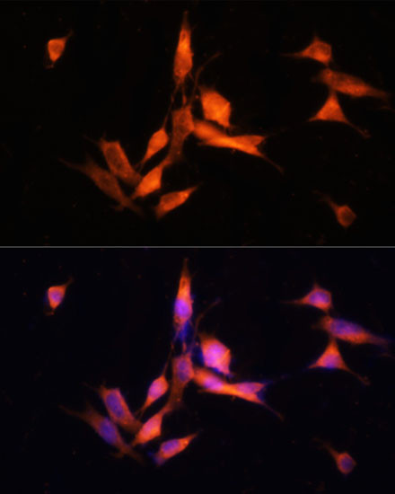 MMP10 Antibody in Immunocytochemistry (ICC/IF)