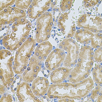 MMP10 Antibody in Immunohistochemistry (Paraffin) (IHC (P))