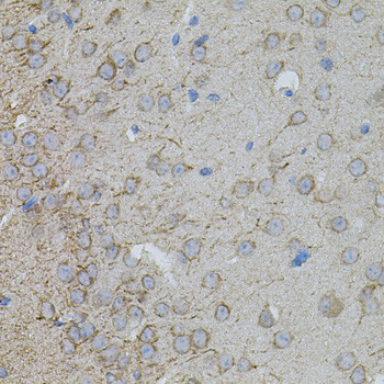 MMP10 Antibody in Immunohistochemistry (Paraffin) (IHC (P))