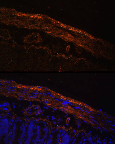 MYL9 Antibody in Immunohistochemistry (Paraffin) (IHC (P))