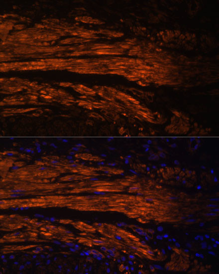 MYL9 Antibody in Immunohistochemistry (Paraffin) (IHC (P))