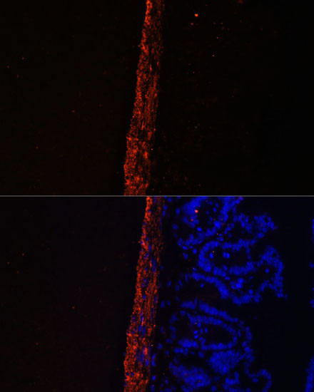 MYL9 Antibody in Immunohistochemistry (Paraffin) (IHC (P))