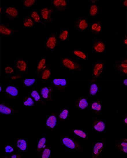 AKAP8 Antibody in Immunocytochemistry (ICC/IF)