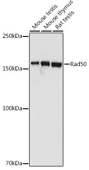 RAD50 Antibody in Western Blot (WB)