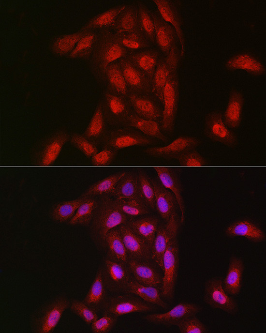 NOTCH3 Antibody in Immunocytochemistry (ICC/IF)