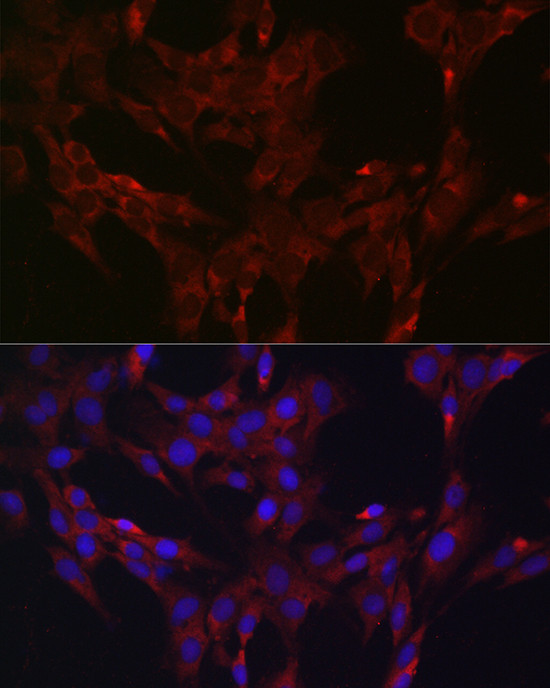 MKP3 Antibody in Immunocytochemistry (ICC/IF)