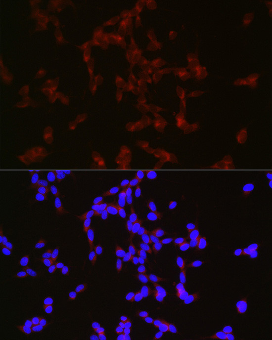 NPY Antibody in Immunocytochemistry (ICC/IF)