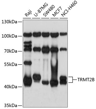 TRMT2B Antibody in Western Blot (WB)