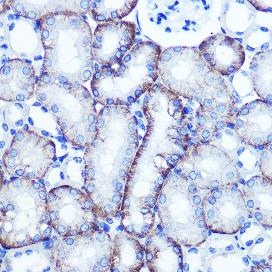 EXTL3 Antibody in Immunohistochemistry (Paraffin) (IHC (P))