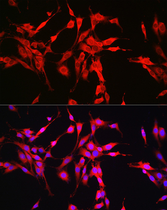 Glutaminase Antibody in Immunocytochemistry (ICC/IF)