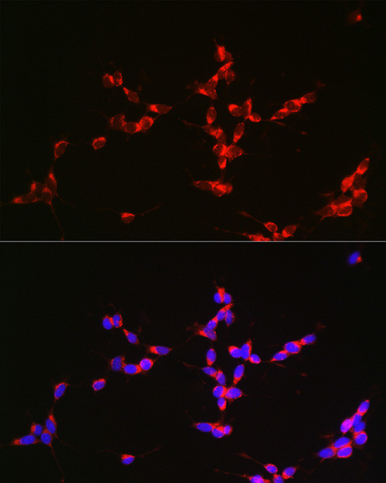 Glutaminase Antibody in Immunocytochemistry (ICC/IF)