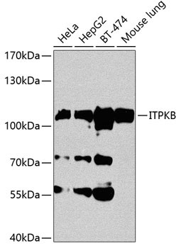 ITPKB Antibody in Western Blot (WB)