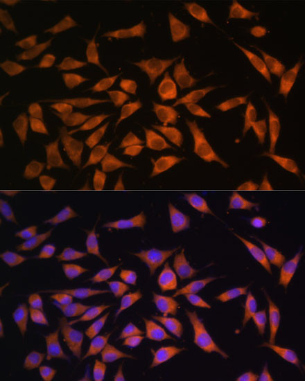 PMM2 Antibody in Immunocytochemistry (ICC/IF)