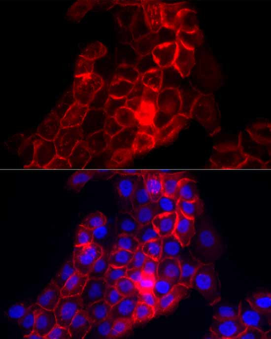 Thrombomodulin Antibody in Immunocytochemistry (ICC/IF)