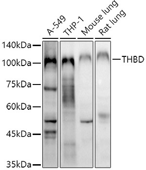 Thrombomodulin Antibody in Western Blot (WB)