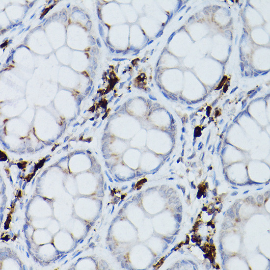 UBE2L6 Antibody in Immunohistochemistry (Paraffin) (IHC (P))