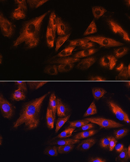 ATXN10 Antibody in Immunocytochemistry (ICC/IF)