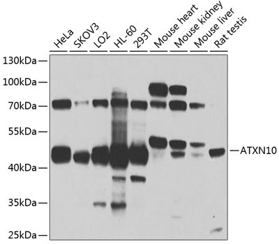 ATXN10 Antibody in Western Blot (WB)