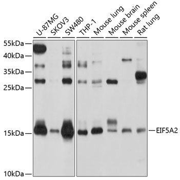 eIF5A2 Antibody in Western Blot (WB)