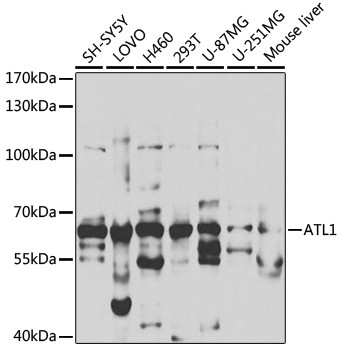 ATL1 Antibody in Western Blot (WB)