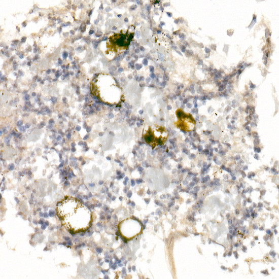 CD42a Antibody in Immunohistochemistry (Paraffin) (IHC (P))