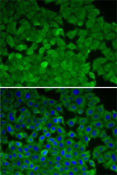 EEF2K Antibody in Immunocytochemistry (ICC/IF)