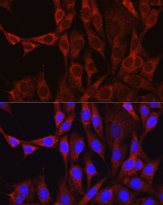 Glutamine Synthetase Antibody in Immunocytochemistry (ICC/IF)